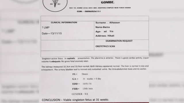 Dis na one old 2015 scan wey Barira family dey claim say she get two kidney