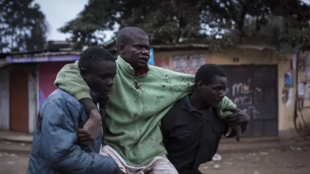 متظاهر مصاب