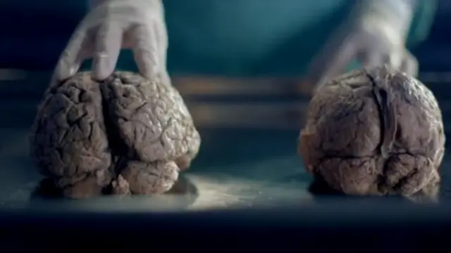 Cerebro de hombre (der.) y de mujer (izq.)