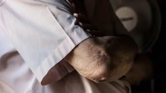 رجل مسن يعقد ذراعيه