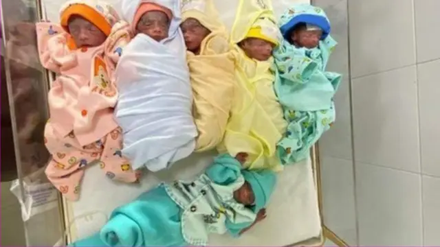 கருவில் ஊட்டச்சத்து குறைபாடு உண்டானது குழந்தைகள் இறக்கக் காரணமாகியுள்ளது.