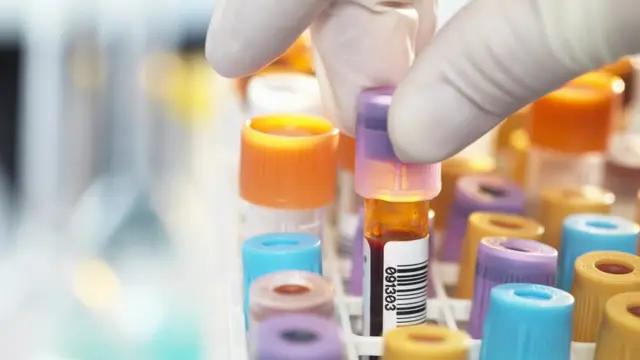 మల్టిపుల్ మయలోమా