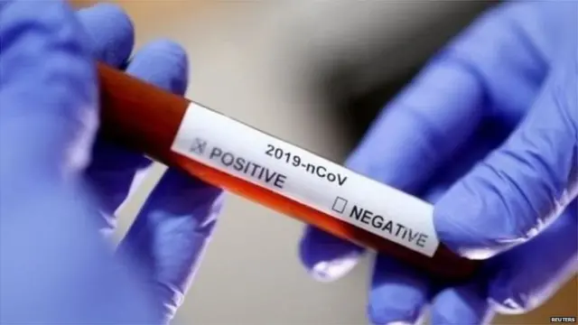ਕੋਰੋਨਾਵਾਇਰਸ