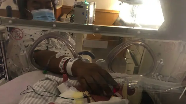 에보니의 딸 레인은 불과 0.88kg의 몸무게로 태어났다