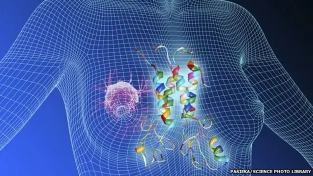 چھاتی کا سرطان