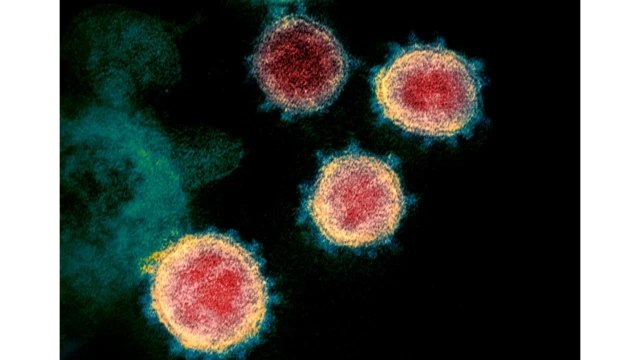 ไวรัสซาร์สซีโอวีทู (SARS-CoV-2) เมื่อมองผ่านกล้องจุลทรรศน์อิเล็กตรอนไวรัสซาร์สซีโอวีทู (SARS-CoV-2) เมื่อมองผ่านกล้องจุลทรรศน์อิเล็กตรอน