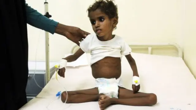 ஏமனில் பேரழிவு நிலை