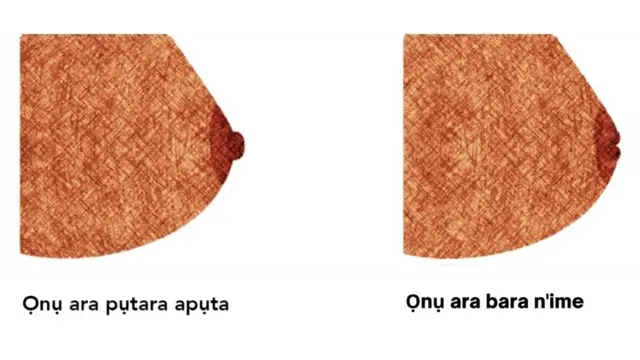 Ọnụ ara