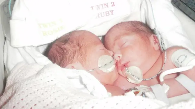 Las niñas cuando eran bebés