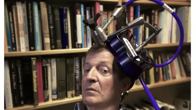 تحریک مغناطیسی درون‌جمجمه‌ای