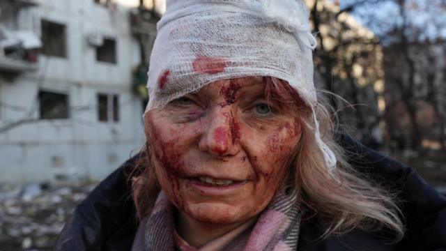 Uma mulher ferida em Kharkiv, Ucrânia