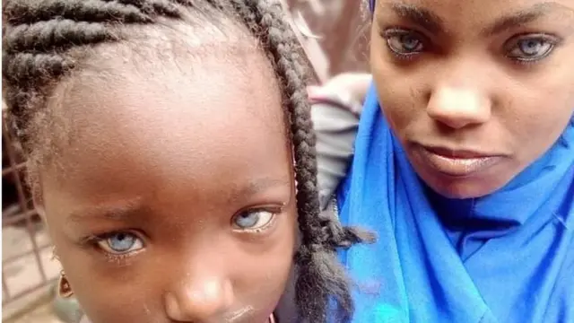 Awọn ọmọ ti oju wọn ni awọ to yatọ