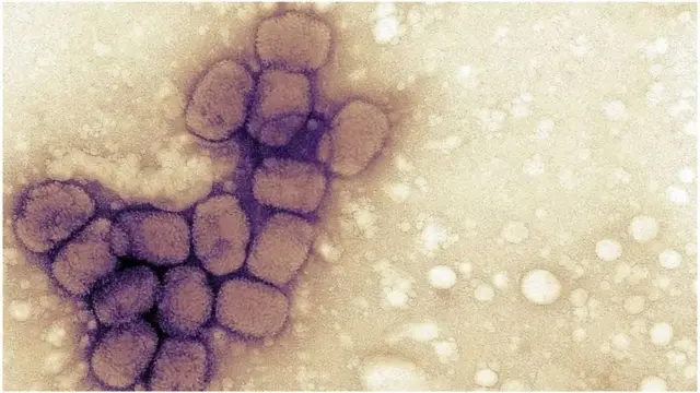 Ka hor fikradda Jenner dadka waxay isku daweyn jireen siyaabo kala duwan