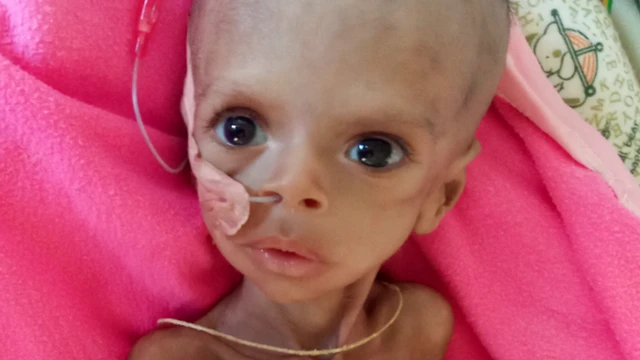 ኣብ ትግራይ ብሰን ሕጽረት መግቢ ዝሳቐ ዘሎ ሱራፌን መዓርግ 22 ታሕሳስ 2021