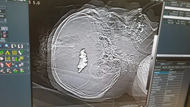 шпиталь у Краматорську