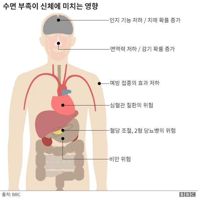 수면 부족은 생각보다 빠르게 우리 몸을 망가뜨린다.