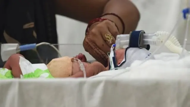 4 கை - 4 கால் குழந்தைகள் பிறப்பது எப்படி?