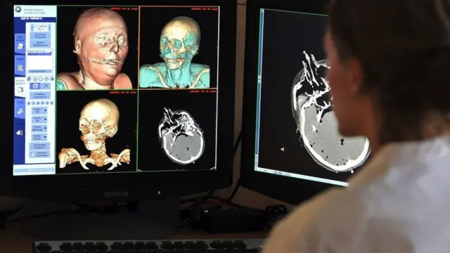 Виртуелне аутопсије раде се уз помоћ слика добијених преко ЦТ скенова, магнетне резонанце и сонографије да би се проучила тела