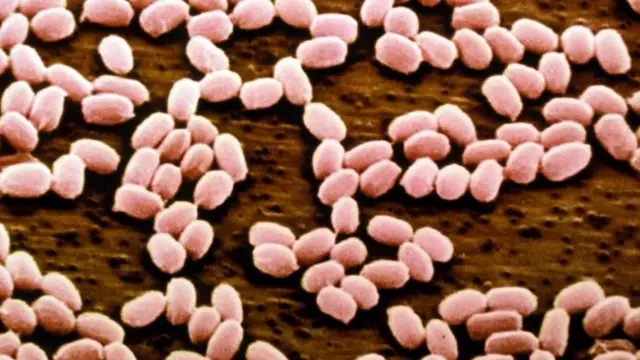 ఆంత్రాక్స్ వ్యాధి