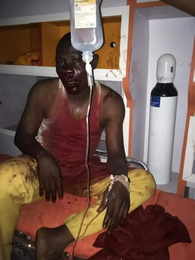 Ẹnikan to fara pa ninu ikọlu