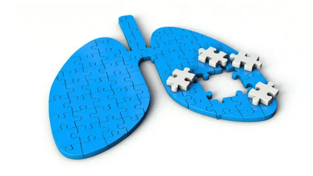 ফুসফুস প্রদাহ।