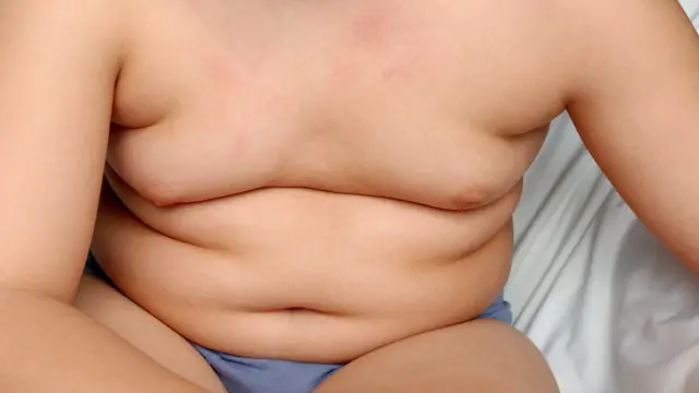 Criança com barriga