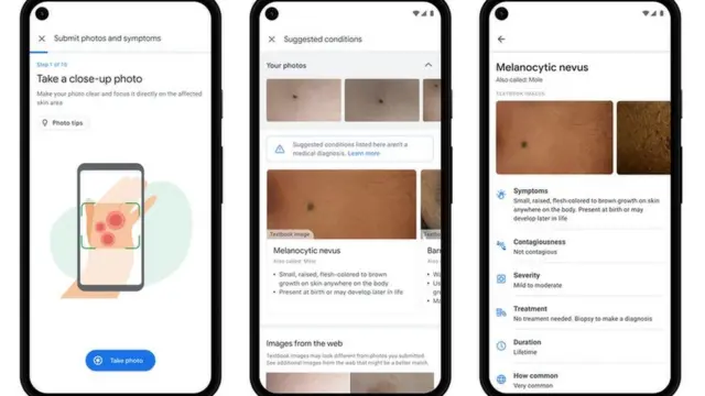 Image de l'outil d'assistance en dermatologie