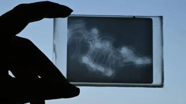 У чашці Петрі в лабораторії триває битва між стійкими до антибіотиків бактеріями та "дружніми" вірусами.