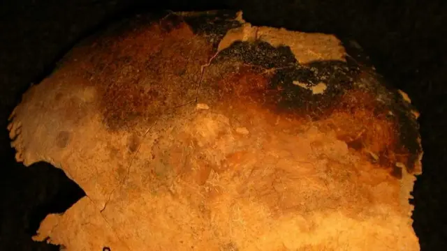 Calavera con marcas de quemadura.