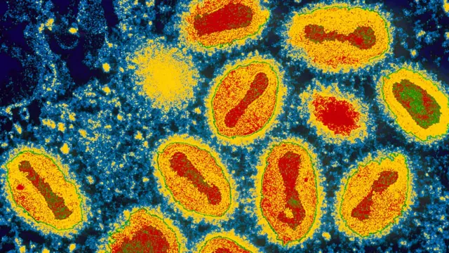 เชื้อไวรัสไข้ทรพิษ