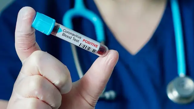 கொரோனா வைரஸின் கொட்டம் அடக்கப்படுமா? - எத்திசையும் தப்பவில்லை