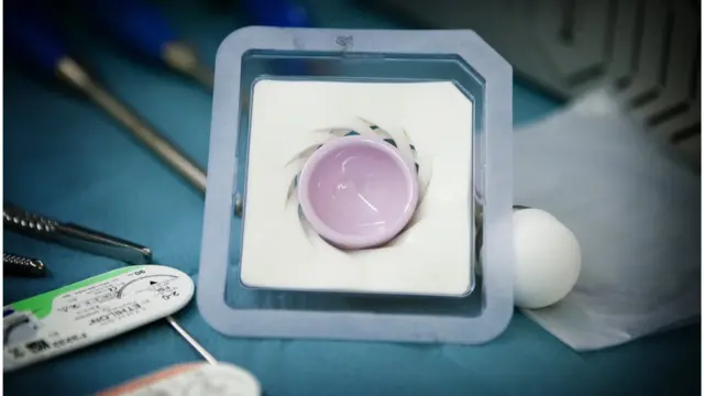 ડિવાઇસની તસવીર