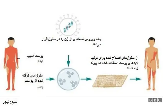 ژن درمانی