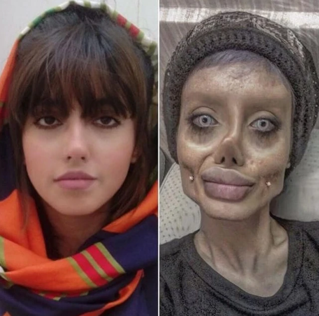 قبل و بعد از عمل