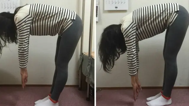 کیوکو پروپورشن