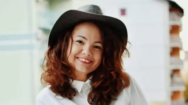 Gordai je doktor rekao da će dete ličiti na nju - imaće kose i razmaknute oči