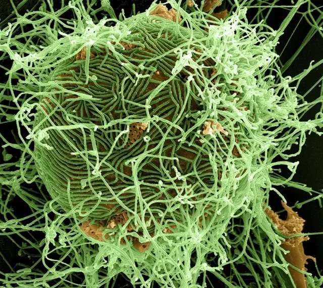 Virusi vya Ebola katika seli iliyoathirika