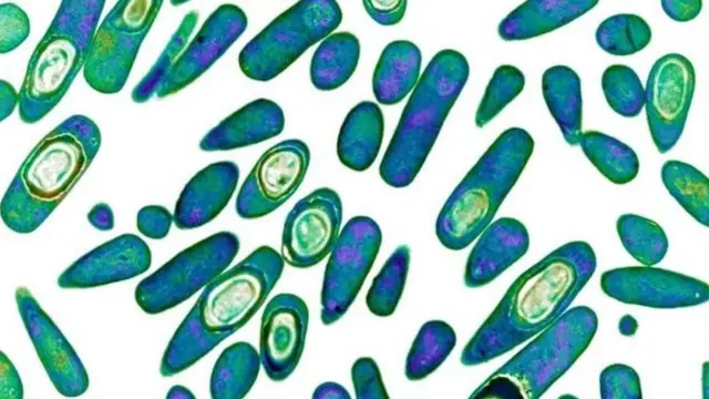 ਸੰਕੇਤਕ ਤਸਵੀਰ