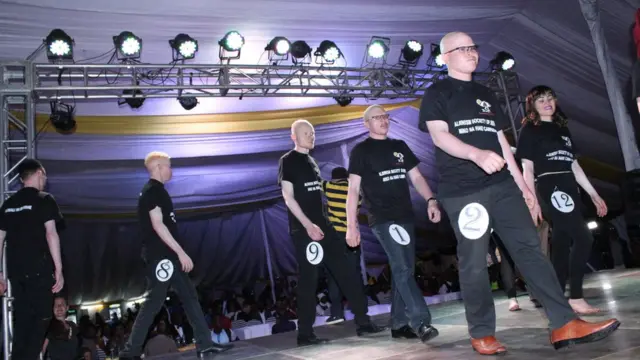 Erick Thomas, awaongoza wanamitindo wenzake kwenye jukwaa wakati wa mashindano ya urembo kwa watu wanaoishi na ulemavu wa ngozi. Lengo lake ni kuhakikisha watu walio na ulemavu huo wamejivunia ngozi yao.