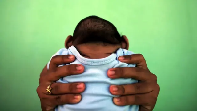 جاكلين تحمل طفلها البالغ من العمر أربعة أشهر، المصاب بصغر حجم الرأس منذ الولادة في البرازيل أثناء تفشي فيروس زيكا في عام 2016