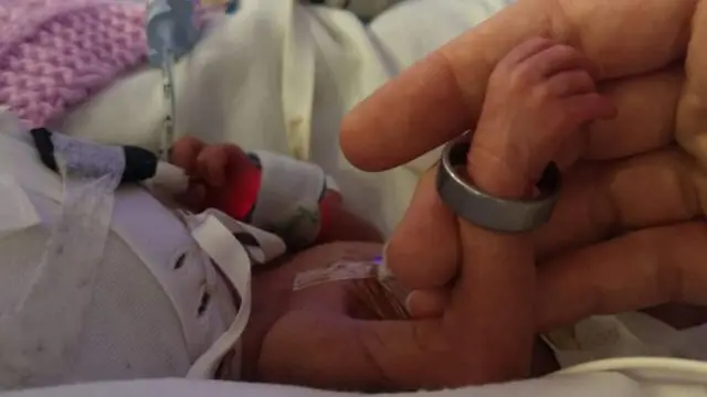 Ivy yavutse ari muto cyane kuburyo impeta ya se yamujyagamo ku kaboko