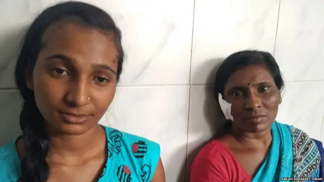 રૂપાલી અને તેમના માતા