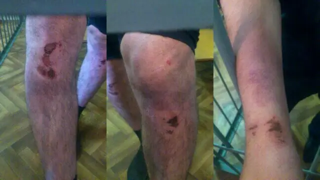 травмы у полицейских