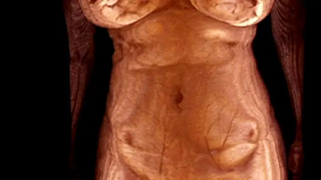 कैसा होगा आज से लाखों साल बाद का मनुष्य?