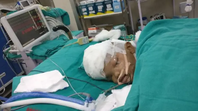 சிகிச்சைக்கு பின்பு மருத்துவமனை வெளியிட்டுள்ள புகைப்படம்