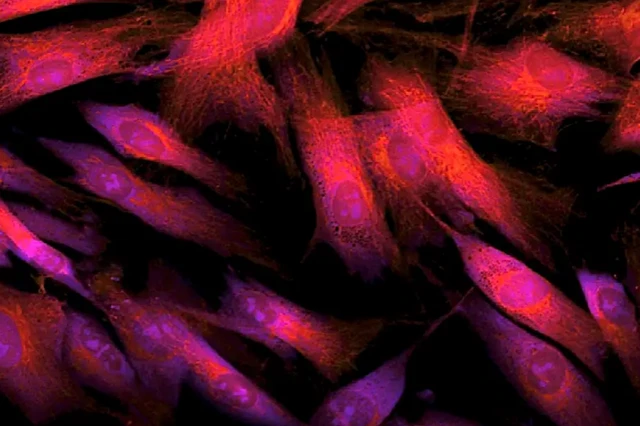 SCIENCE PHOTO LIBRARY