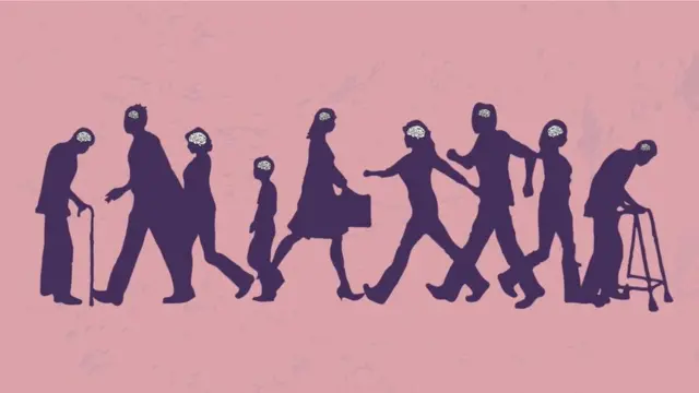 قد يختلف حجم الدماغ من شخص لآخر لكنه ليس مؤشرا دقيقا للذكاء