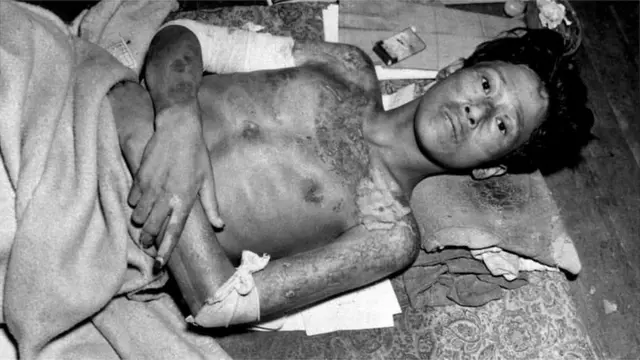 અણુબૉમ્બ