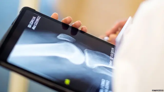 संधिवात