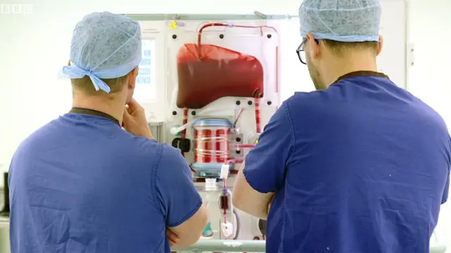 Doctores monitoreando la máquina